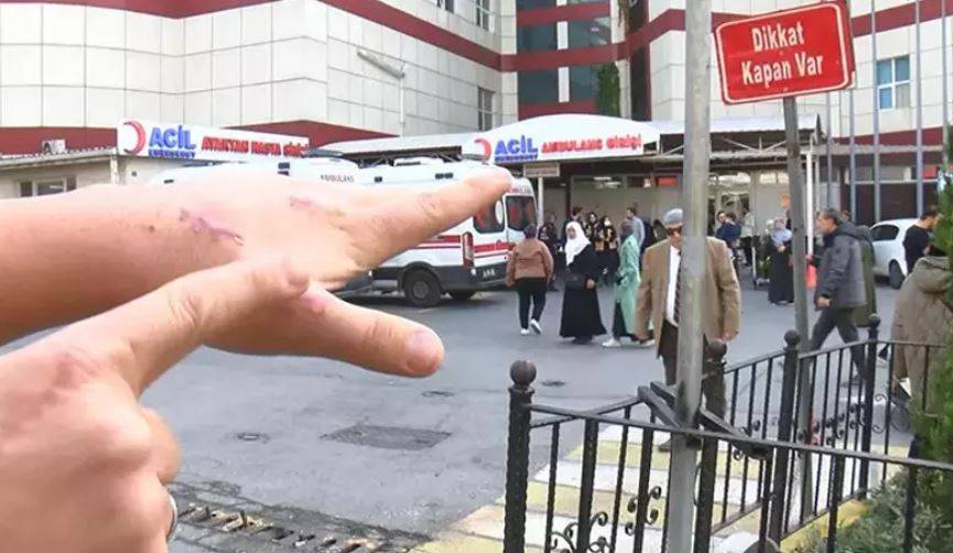 Dünyada bir ilk: Kedisi tarafından ısırılan vatandaşın 13 gün sonra baş parmağı düştü 4