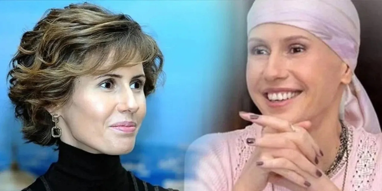 Esma Esad'ın akut lösemi mücadelesi kötüleşiyor