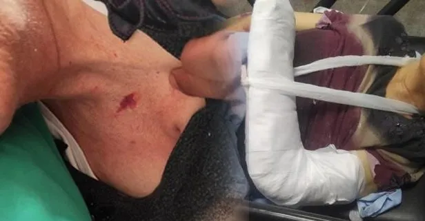 Özel hastanede kan donduran olay! Yaşlı kadının kolunu kırıp darp ettiler