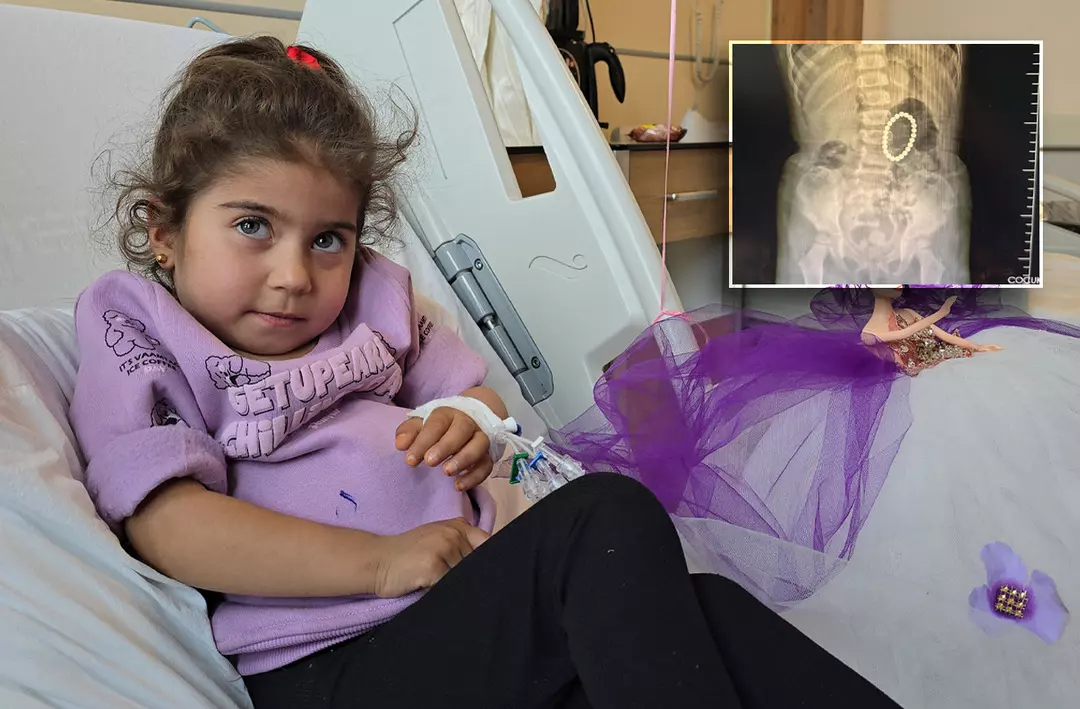 Karın ağrısı şikayetiyle gitti doktorlar hayrete düştü