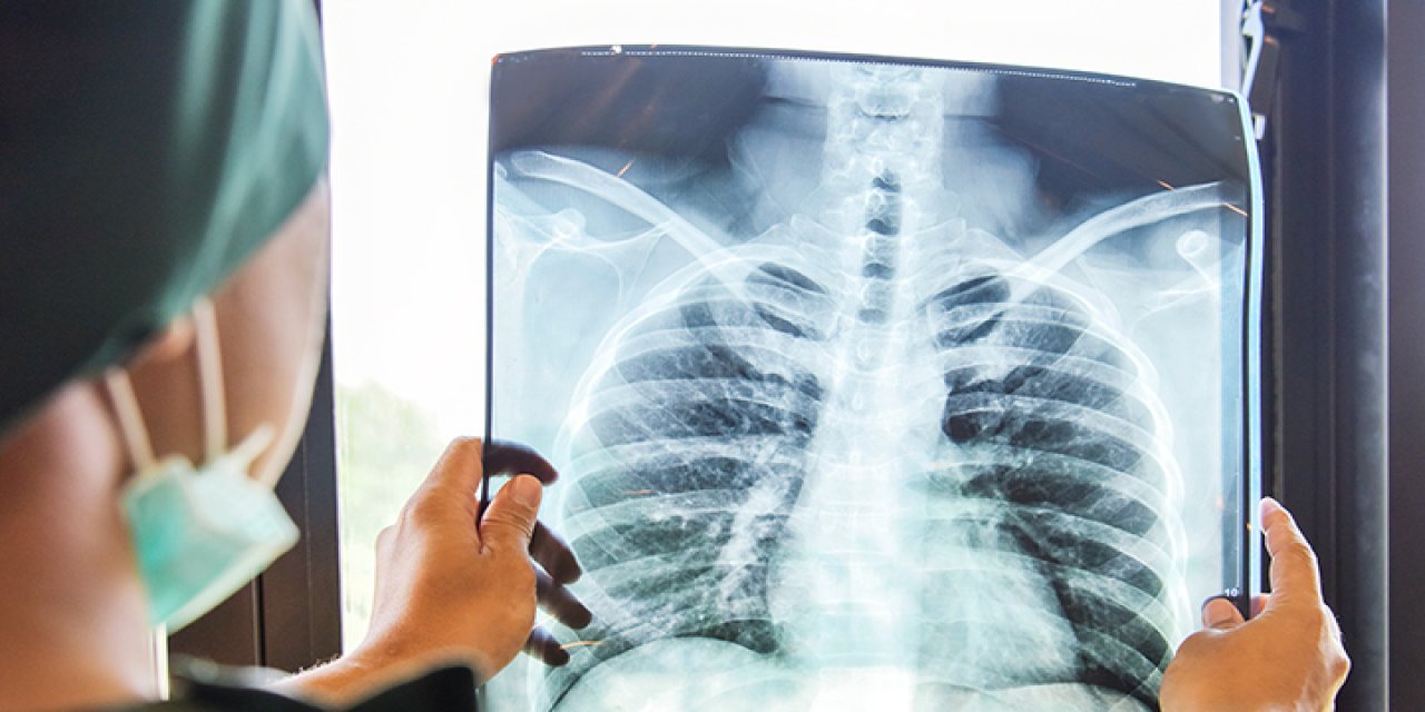 Türkiye'de vaka patlaması yaşandı: 5 yaşındaki çocuk bu hastalıktan yaşamını yitirdi