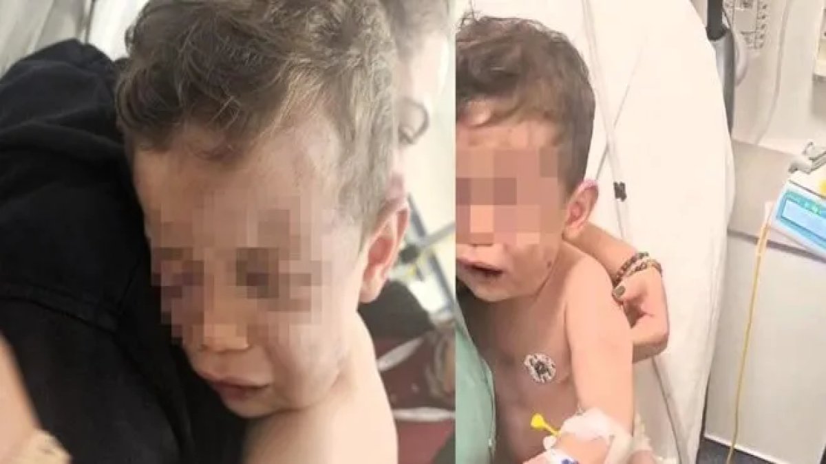 Denizli'de dehşet: 2 yaşındaki bebek, annesinin sevgilisi tarafından öldüresiye dövüldü!
