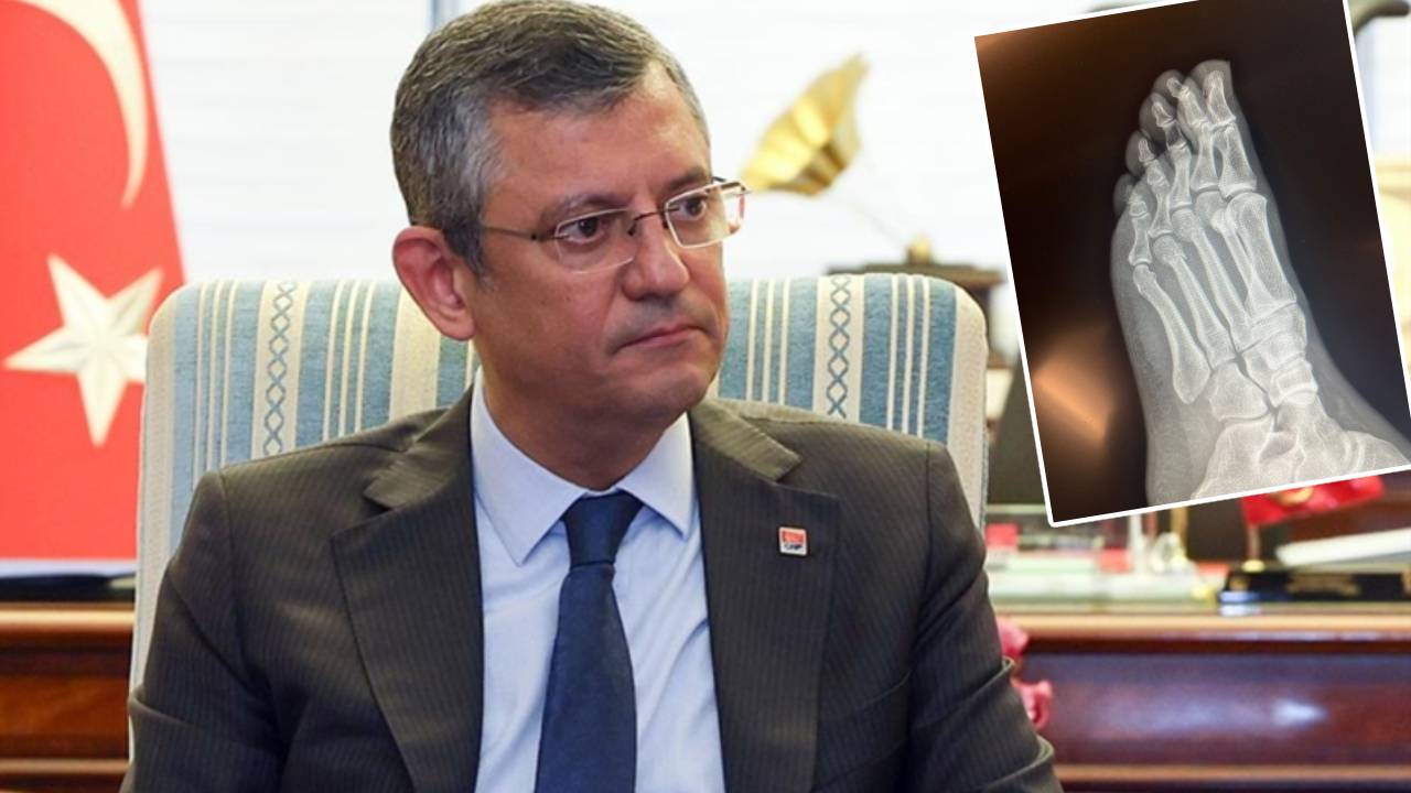 CHP lideri Özel'in ayağı kırılmıştı: Tarihsel husumetimiz var