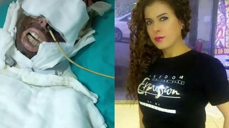 Eski sevgiliden kezzap vahşeti: Uykusunda saldırdı evin suyunu elektriğini kesti