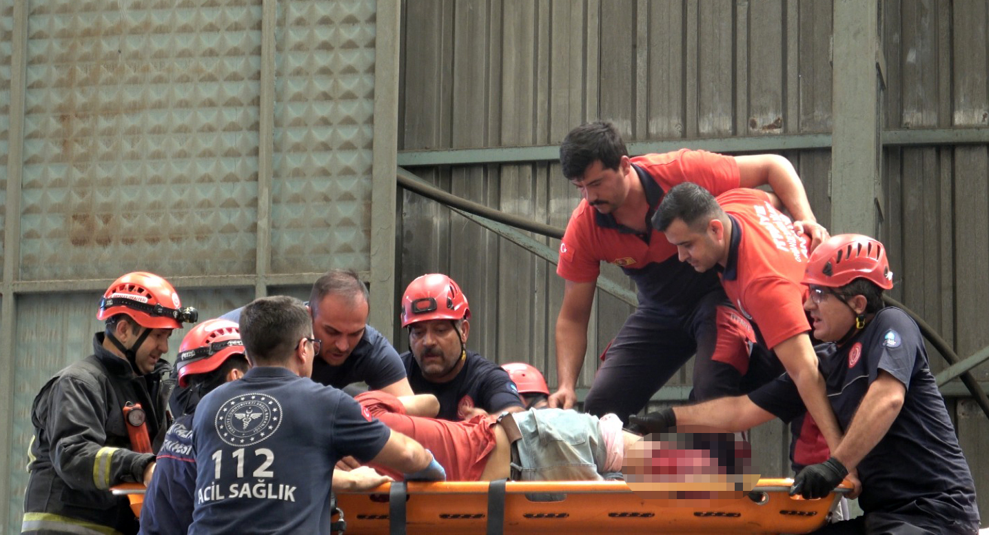 Fabrikada feci kaza: İşçinin iki bacağı da koptu