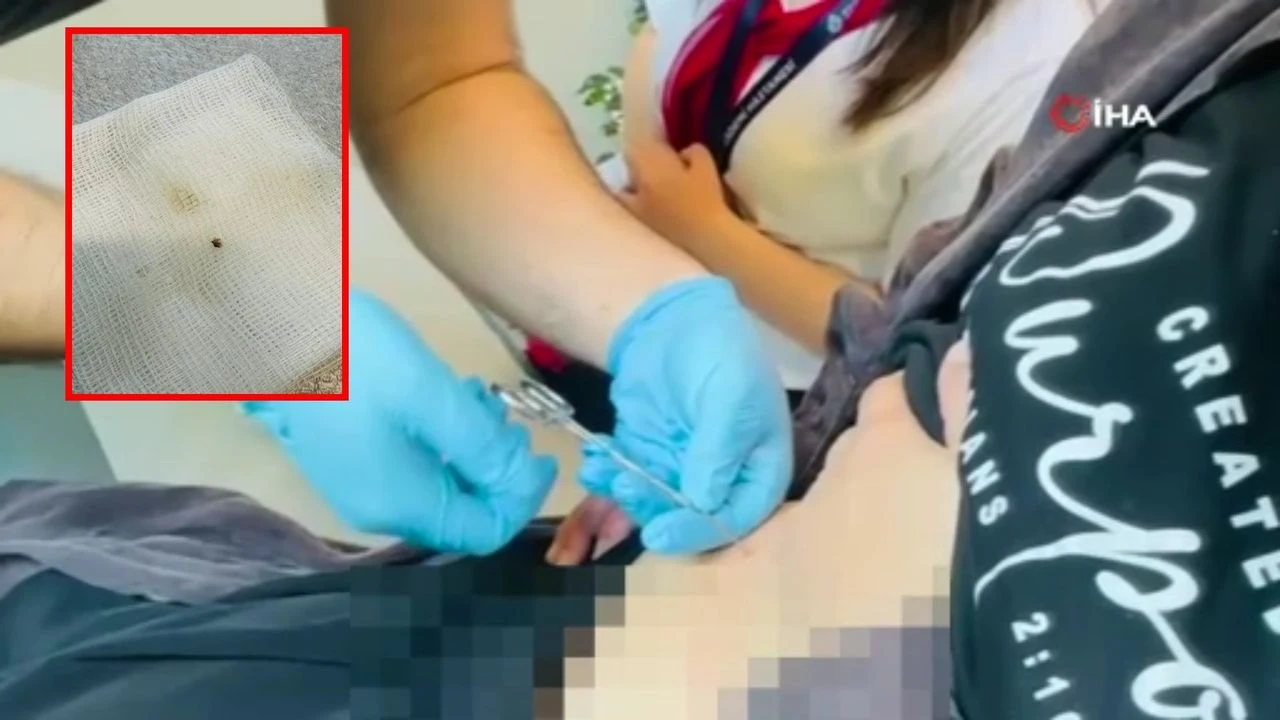 Halsizlik şikayeti ile gitti karnında kene çıktı