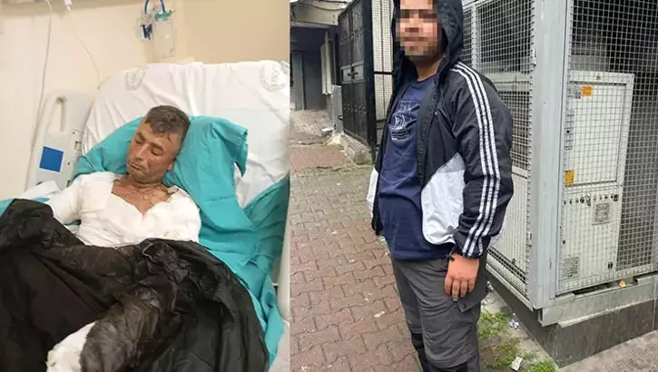 Gaziosmanpaşa'da dehşet: Engelli vatandaşın telefonunu çalıp üzerine benzin döküp yaktı