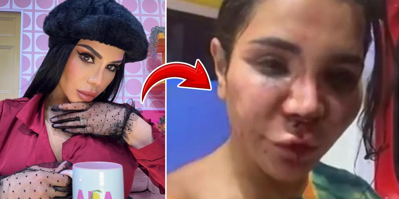 Sosyal medya fenomeninin evine giren hırsız önce dövdü sonra tecavüz etti! DNA'yı yok etmek için çamaşır suyu döktü