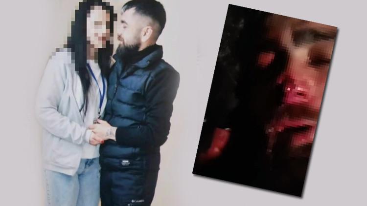 Ankara'da kan donduran olay! Evli kadından eski sevgilsine işkence: Burnu ve kulağı koptu