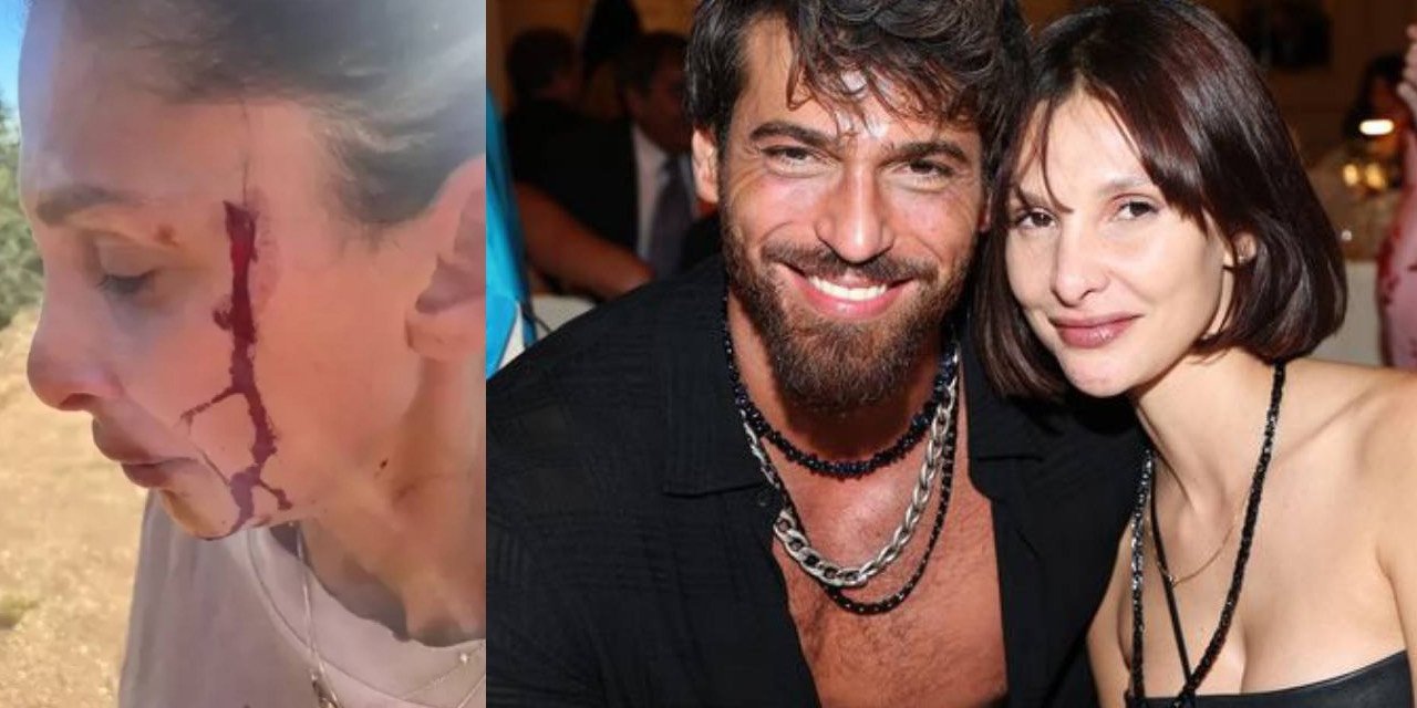 Can Yaman’ın sevgilisi Sara Bluma, şiddet iddiasıyla konuştu: Artık susmayacağım