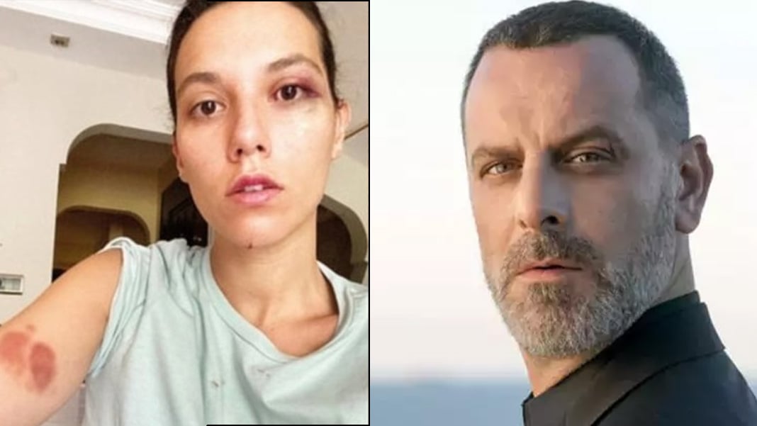 Ozan Güven’e 2 yıl 3 ay hapis: Abajur “silah” sayıldı