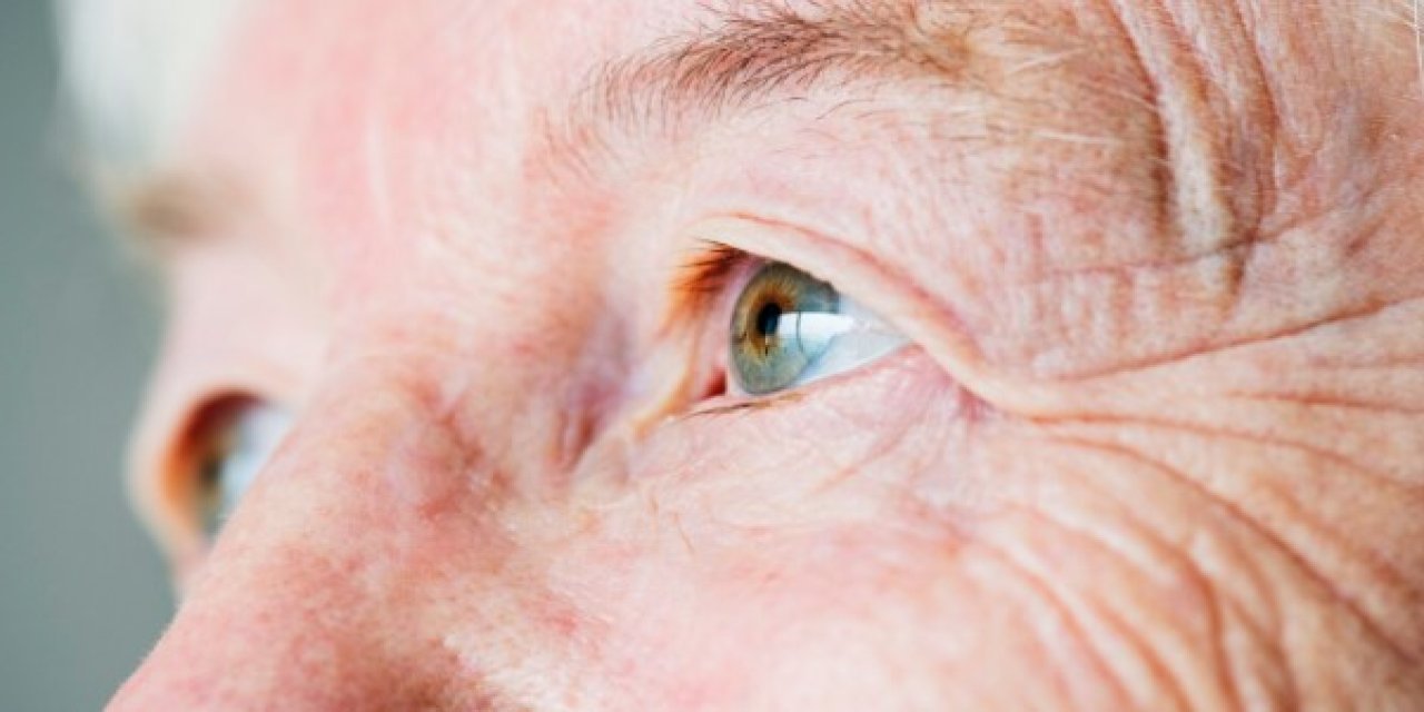 Yaşlanma bir hastalık mı? Yeni bilimsel bulgular açıklandı