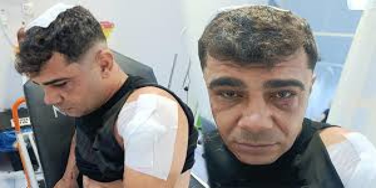 İş görüşmesine gitti ölümden döndü! 5 kişinin saldırısına uğradı
