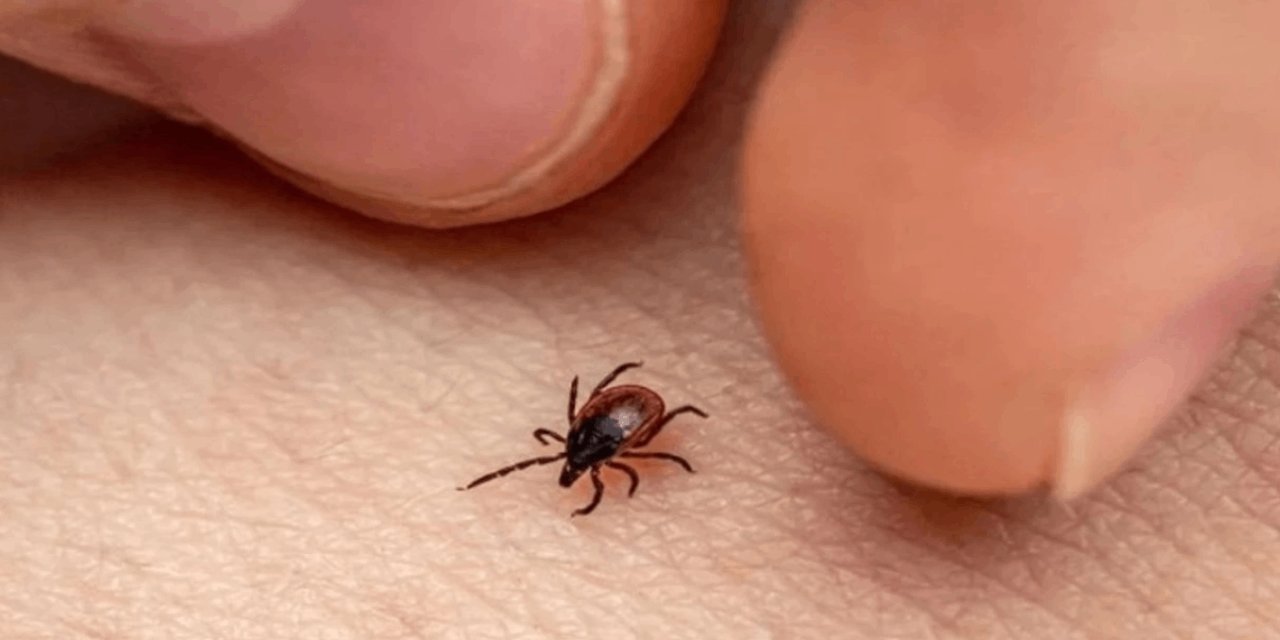 Bu hastalık kene ısırığı sonrası ortaya çıktı! Alpha-gal sendromu hızla yayılıyor