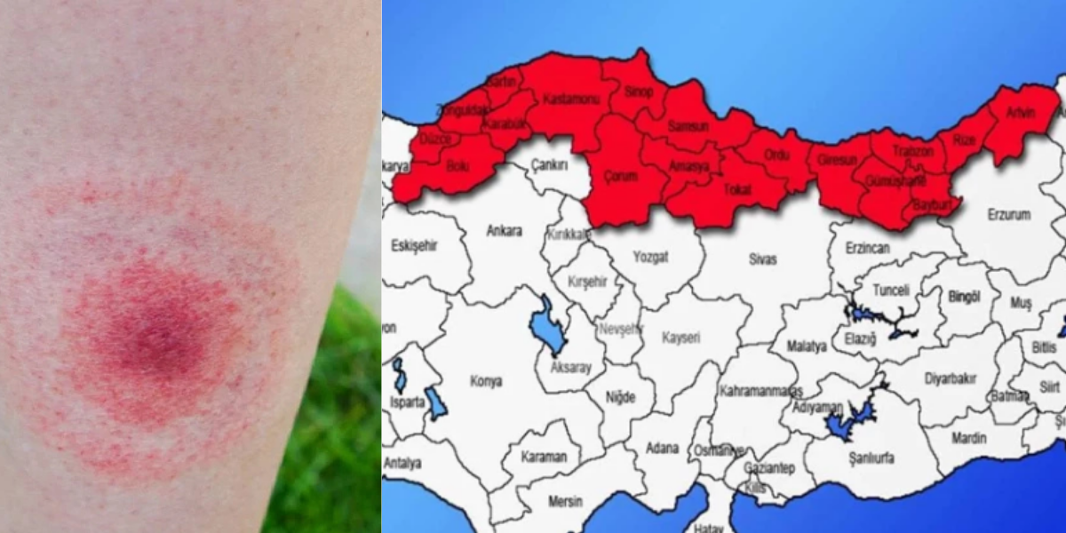 Türkiye'nin o bölgesinde salgın alarmı! Ölüme kadar götürüyor