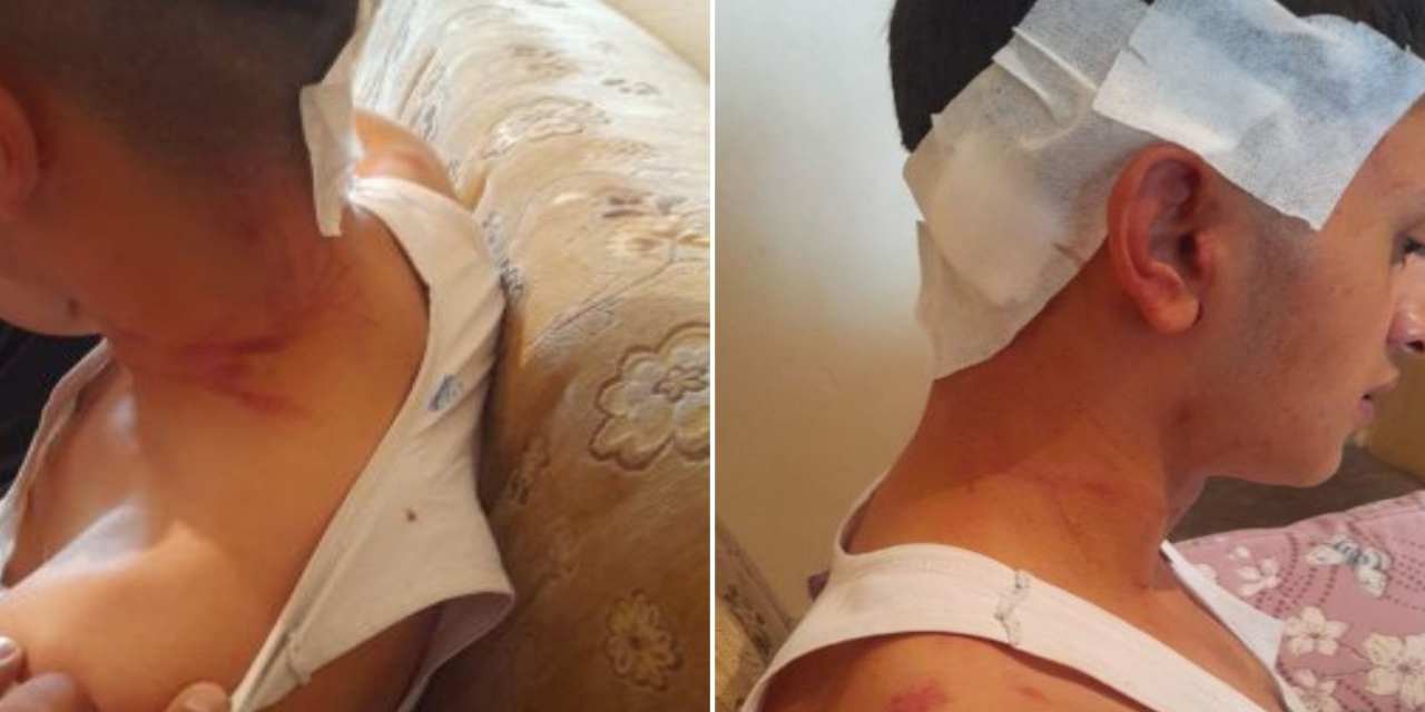 MHP'li belediye başkanının oğulları hakkında flaş darp iddiası