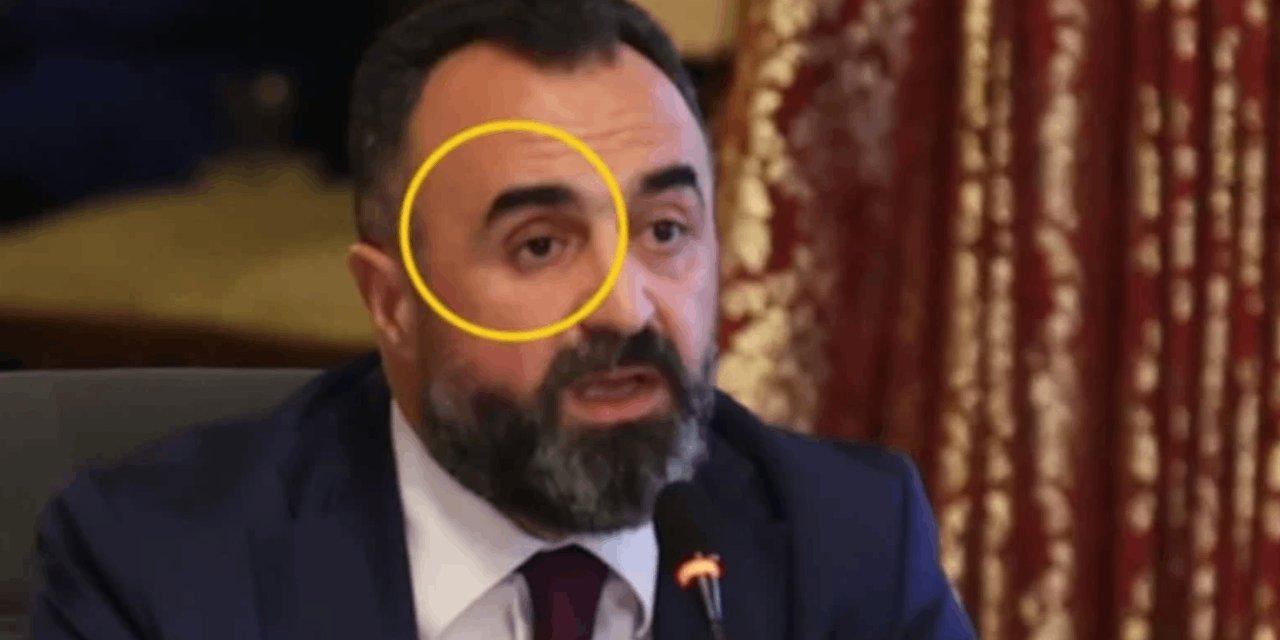 Gazi, komisyon toplantısında sağ gözünü eline aldı! Vekiller dondu kaldı