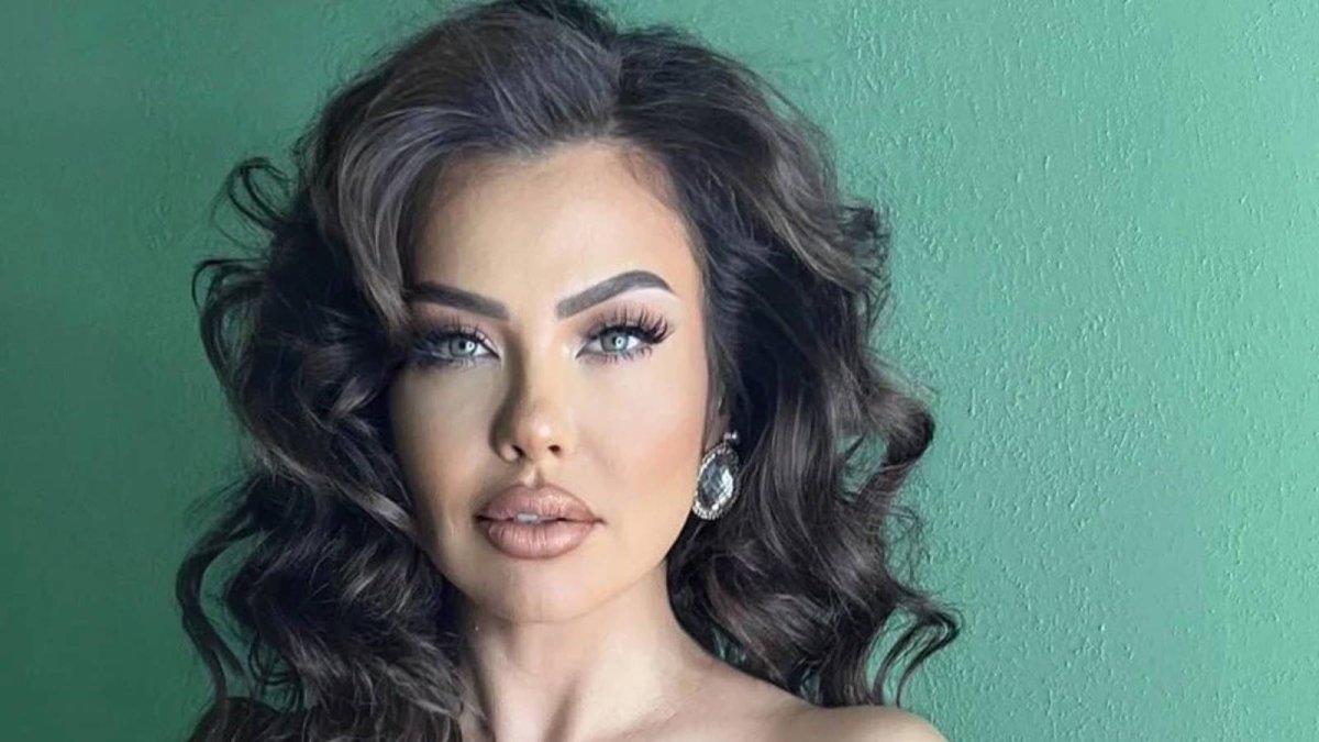 Şarkıcı Lara’dan üzen haber: Beyninde kitle tespit edildi