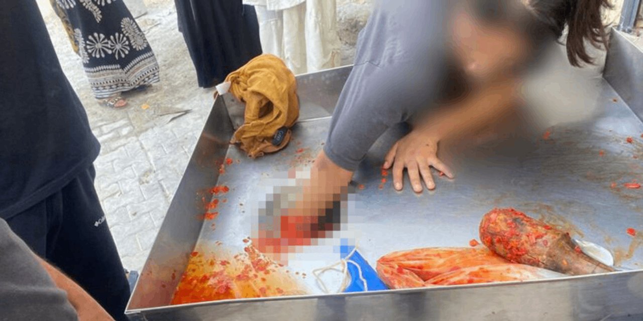 Elini salça makinesine kaptıran genç kız hakkında yeni gelişme