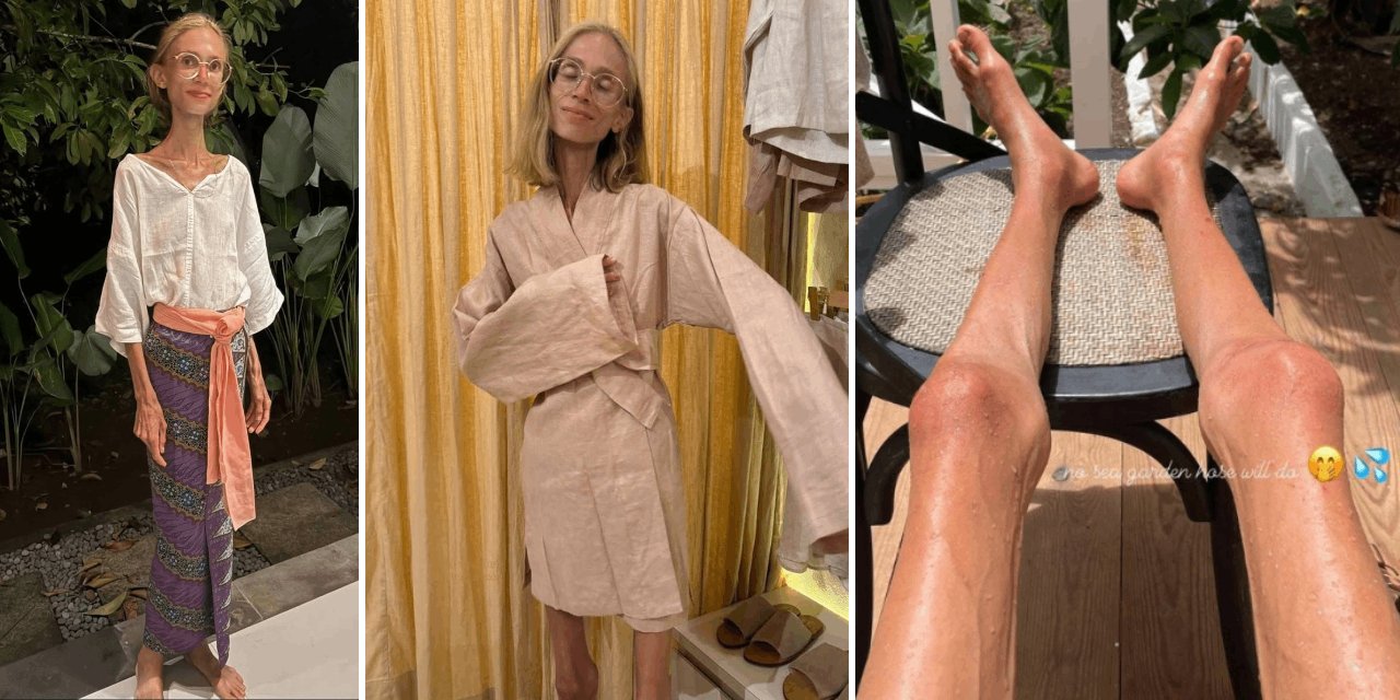 Sadece meyve yiyerek 23 kiloya düştü! 27 yaşında hayatını kaybetti