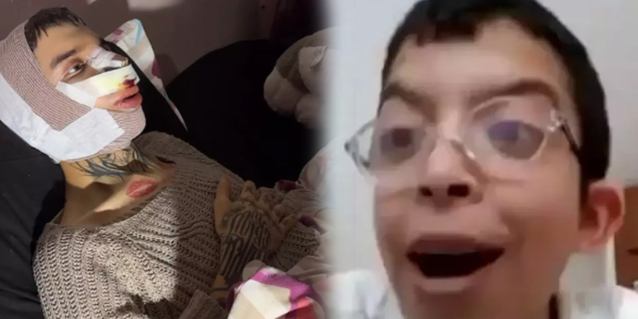 Tablet Reis 5 kez ameliyat masasına yattı: Zorbalık Onurcan Güzel'in hayatını değiştirdi