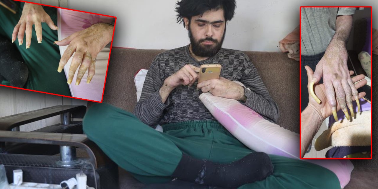 Deprem sonrası hayatı değişti: 3 yıldır evden çıkmıyor: Duş almıyor, tırnaklarını kesmiyor