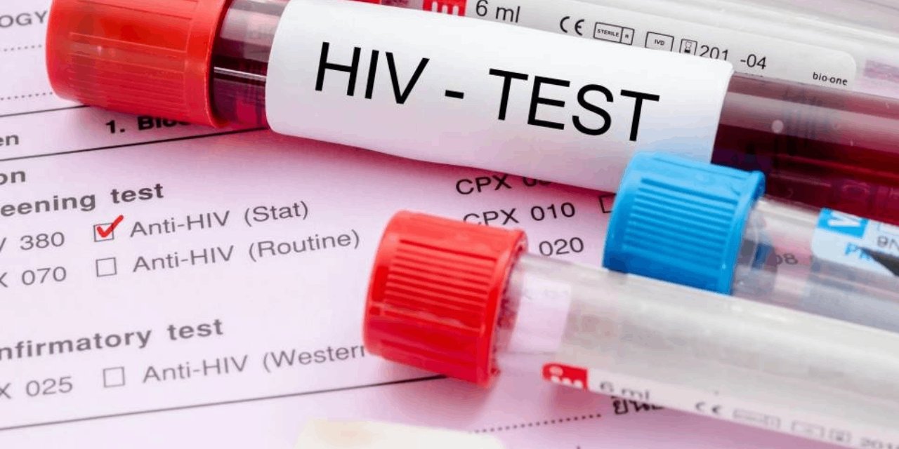 AIDS hastalığı için yeni gelişme: Antikor bulundu!