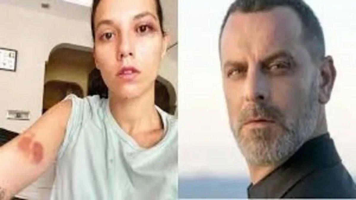 Oyuncu Ozan Güven'in hapis cezası onandı