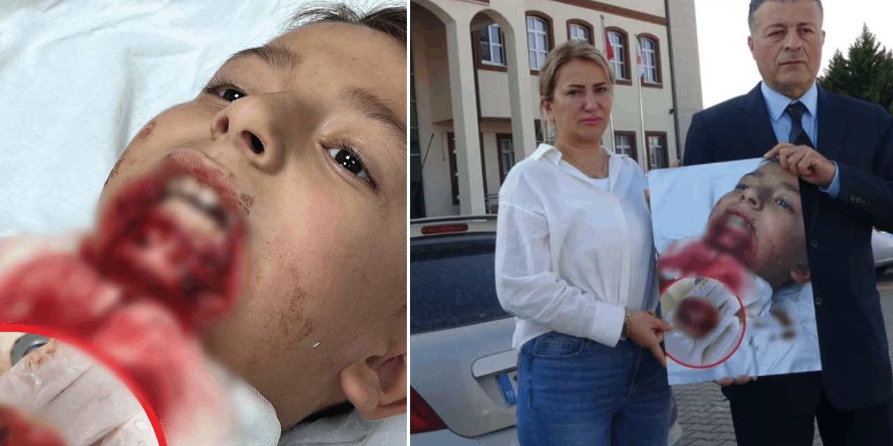 Okul bahçesinde dehşet! 7 yaşındaki çocuğun çenesi koptu
