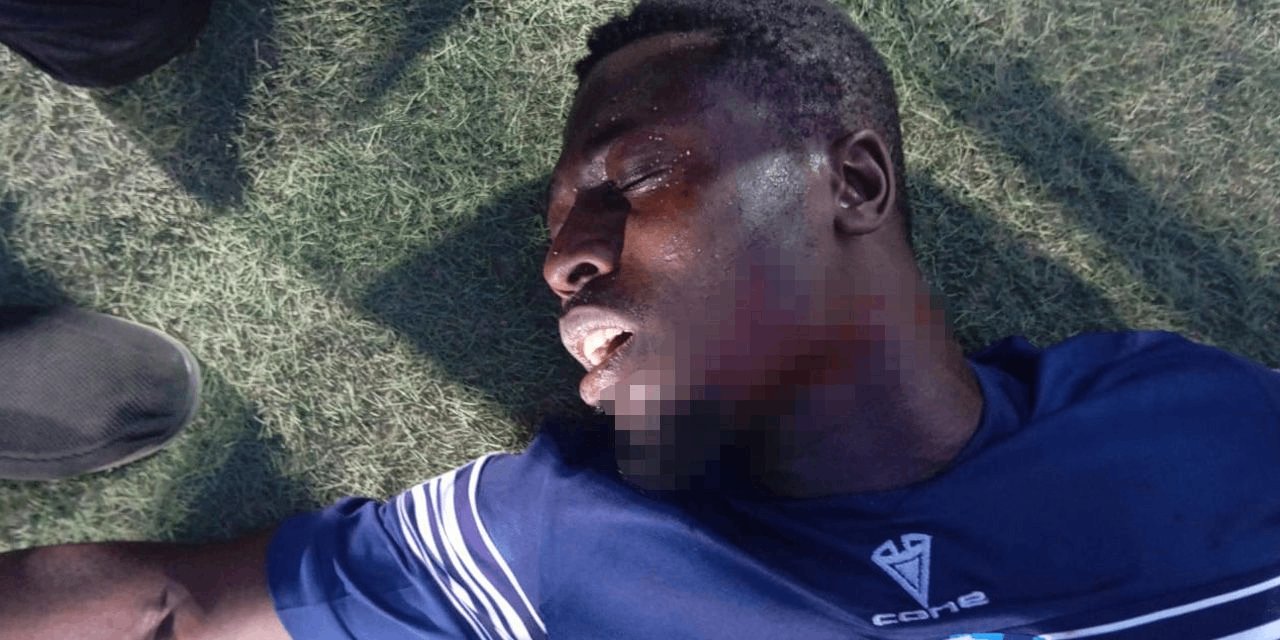 Futbol sahasında dehşet: Taraftar futbolcunun boğazını kesti