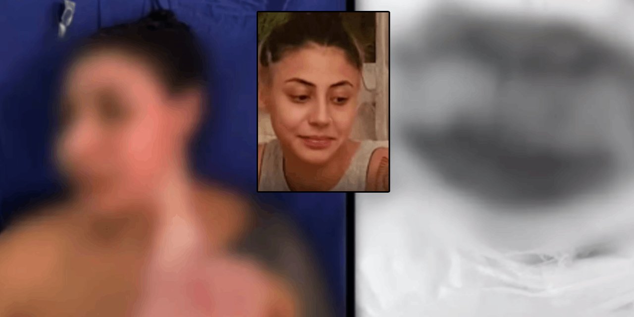 Kadıköy'de korkunç anlar: Bir kadın başka bir kadını "kıskançlık kriziyle" yaktı