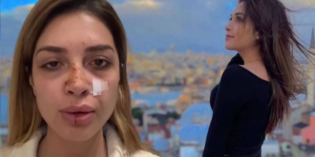 Ünlü şarkıcı sokak ortasında şiddet gördü: Karakolda tehdit edildim, çene ve baş kısmıma darbe aldım