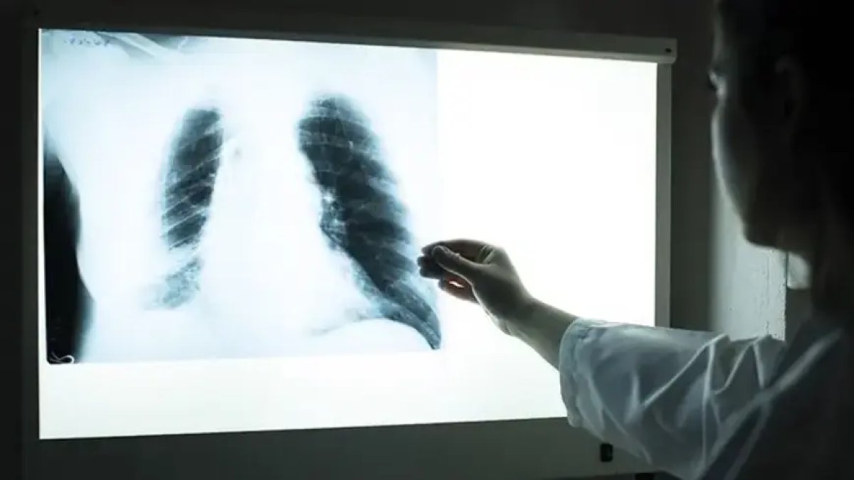 DSÖ verileri paylaştı: Dünyanın en bulaşıcı hastalığı yılda 1 milyon can alıyor