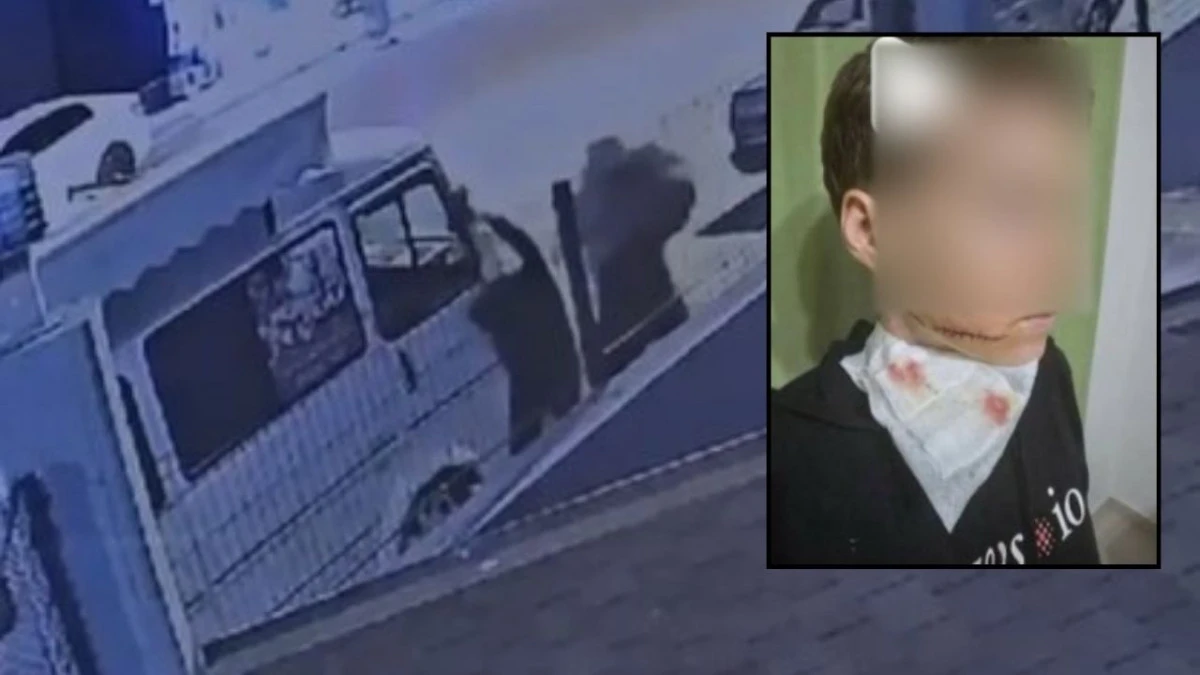 Antalya'da dehşet! Önce yumruk attı sonra bıçakladı