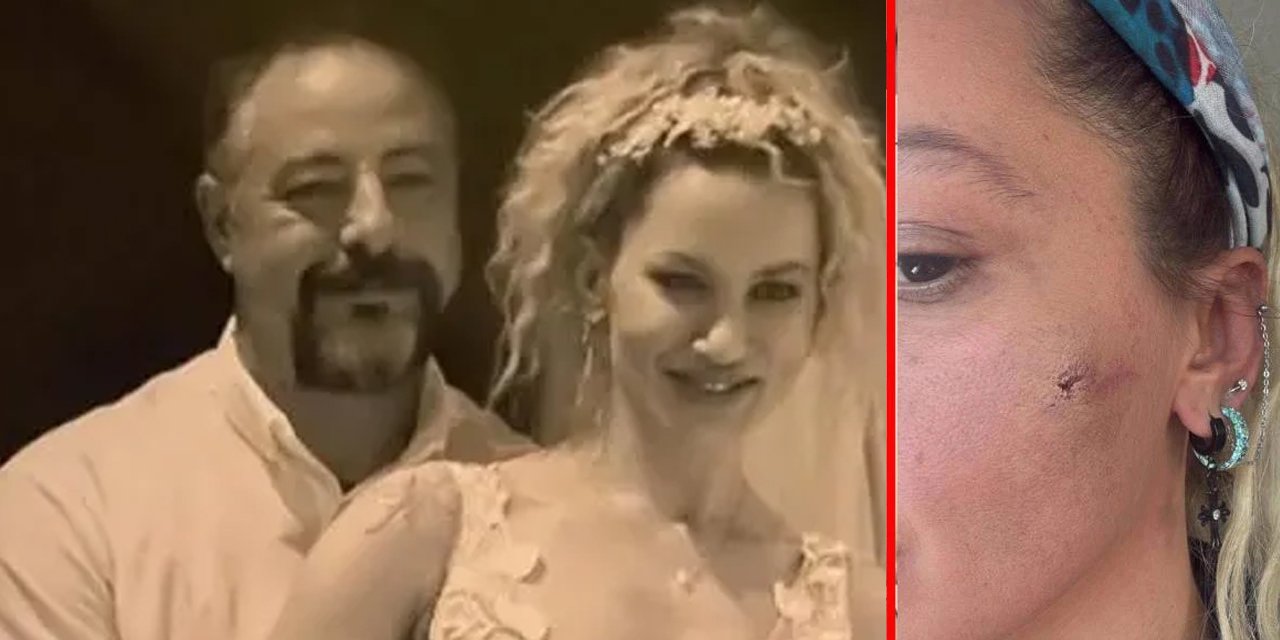 Yıldız Asyalı'nın üçüncü evliliğinde kabus! Eşinden şiddet gördüğünü açıkladı