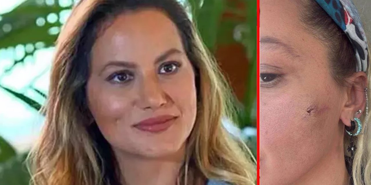 Yıldız Asyalı’nın darp ifadesi ortaya çıktı: "Hem şiddet uyguladı hem de eşyalarımı çaldı"