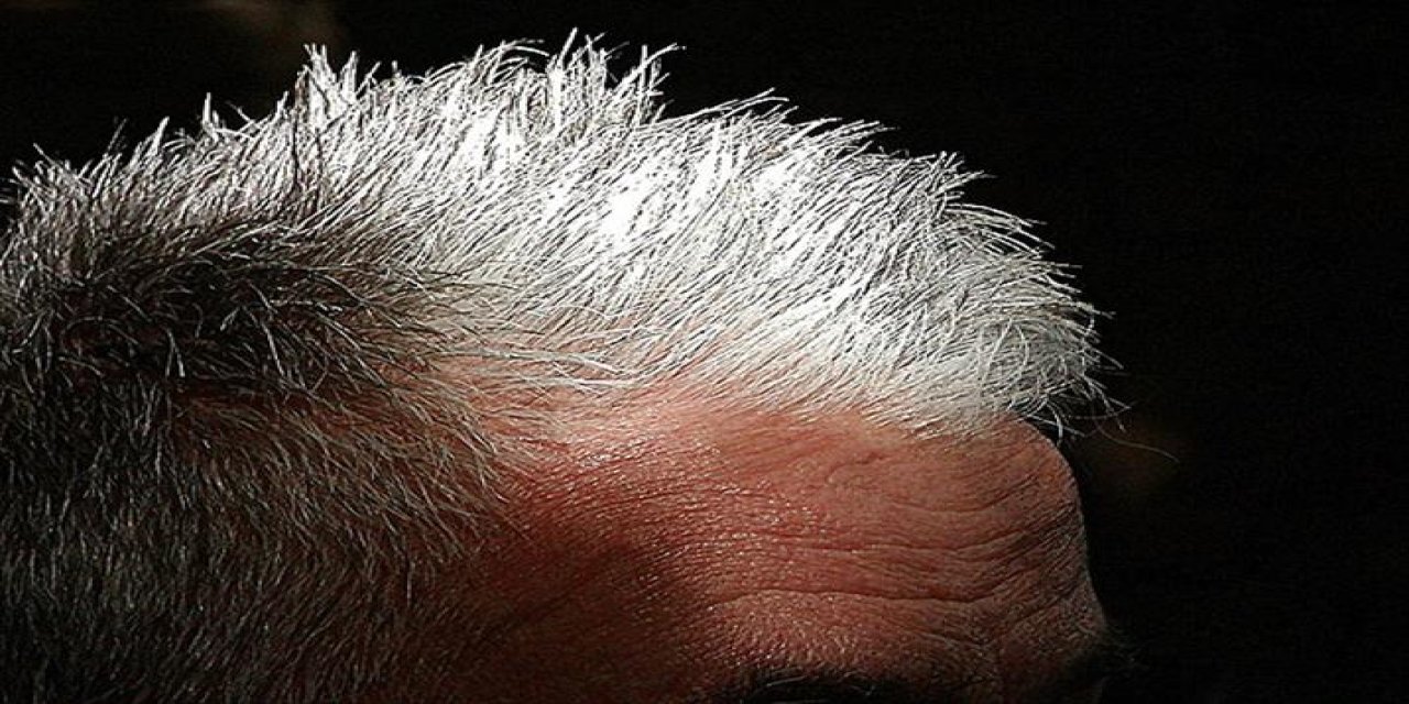 Beyaz saç artık bambaşka anlam taşıyor! Riski gördüğü an pigment üretimini bırakıyor