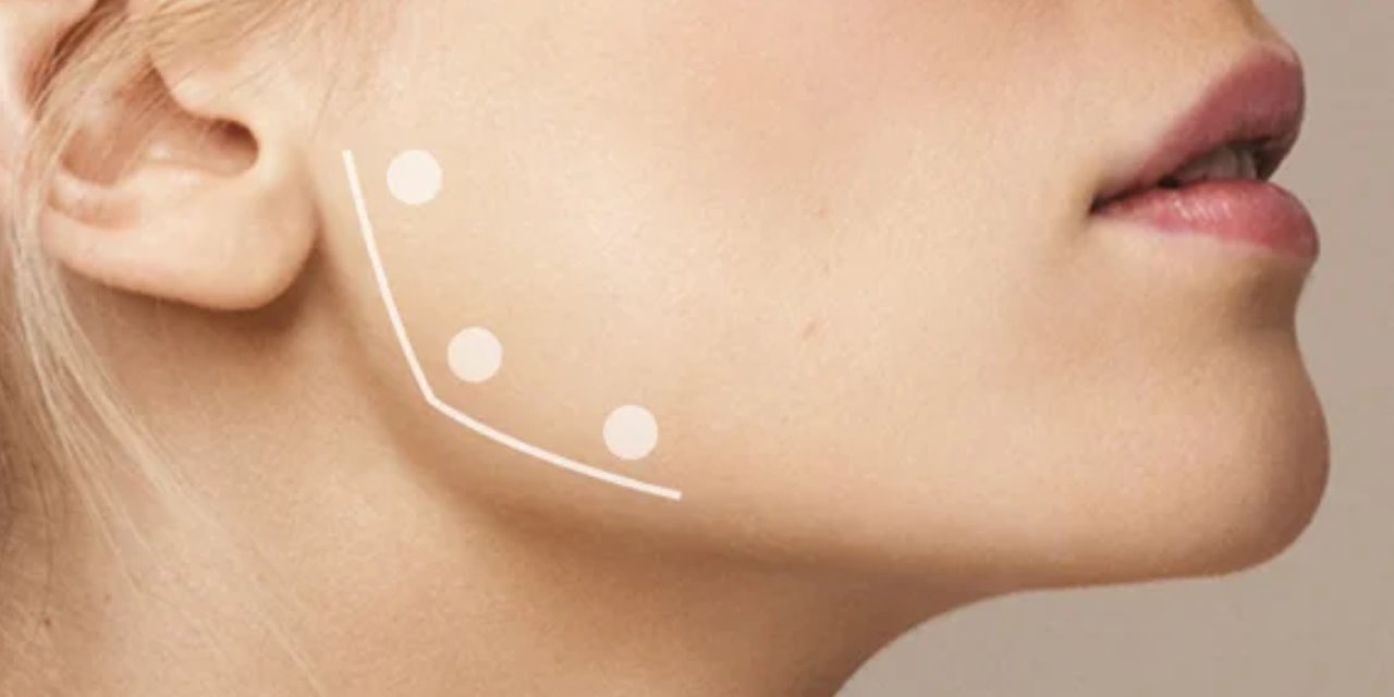 Diş sıkma sorunu olanlar dikkat: Masseter botoksu nedir, çok acıtır mı? Estetik mi tedavi mi?