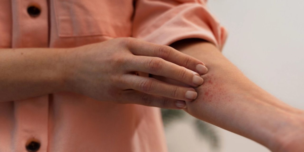 30 yıl sonra yeniden ortaya çıktı: 2 ülkede cüzzam hastalığı tespit edildi