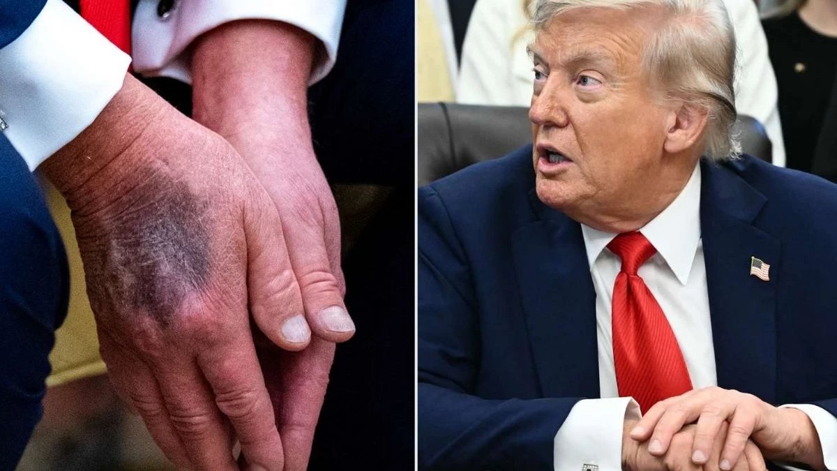 Trump’ın elindeki morlukların sırrı çözüldü