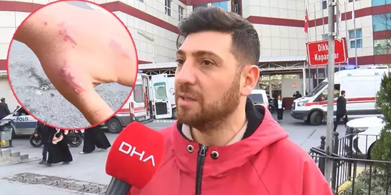 Dünyada bir ilk: Kedisi tarafından ısırılan vatandaşın 13 gün sonra baş parmağı düştü