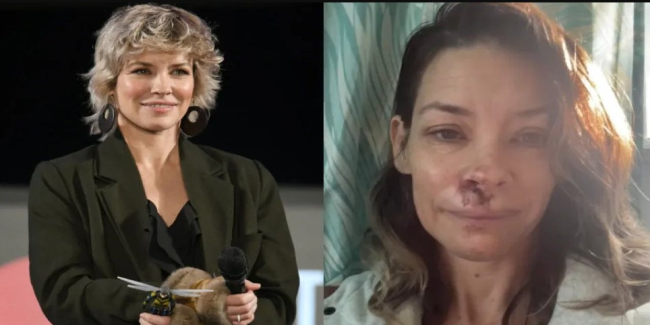 Ünlü Marvel yıldızı ölümden döndü: Evangeline Lilly kayanın üstüne düştü