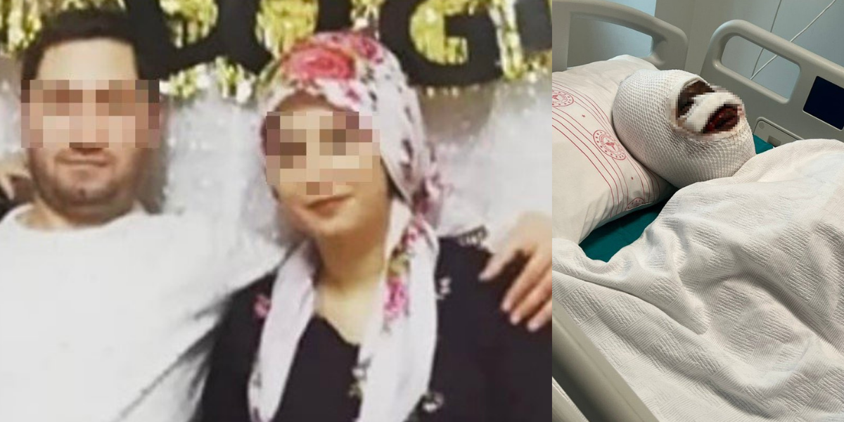 Bir kent bu vahşetle sarsıldı: İşkence edip kezzapla saldırdı