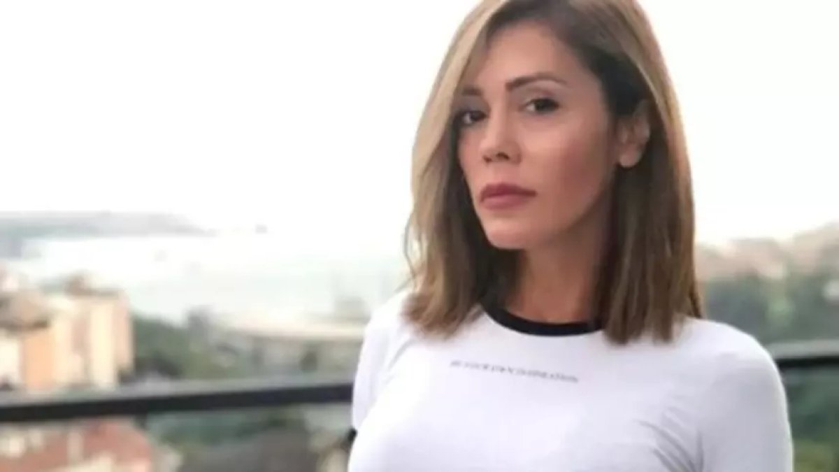 Survivor yarışmacısı Didem Ceran'den yüz estetiği oldu