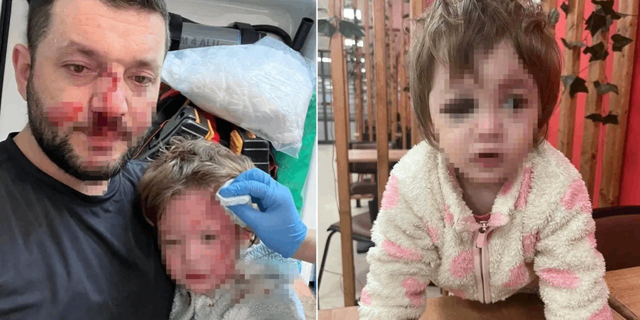 Komşunun sesinden rahatsız oldu: Baba ve 14 aylık kızını odunla yaraladı