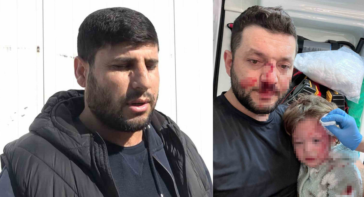 Yalova'da baba ve küçük kızına saldıran şüpheliler kendilerini böyle savununca tepkiler arttı