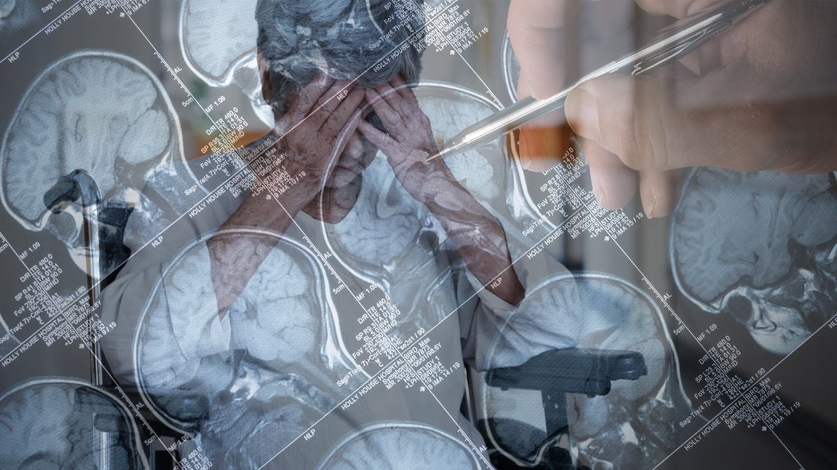 Alzheimer’da yeni devrim: Hastalık 20 yıl öncesinden saptanabilecek