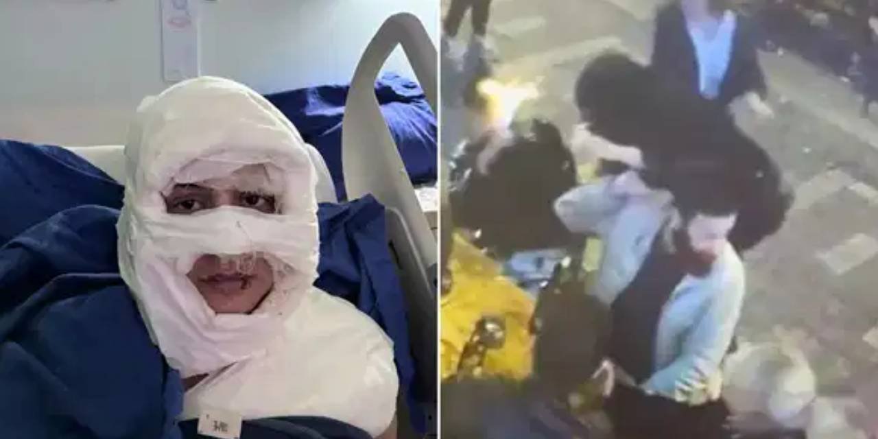 Saçına kolonya döküp yakmıştı: Savunmasında 'çok sarhoştum, pişmanım' dedi