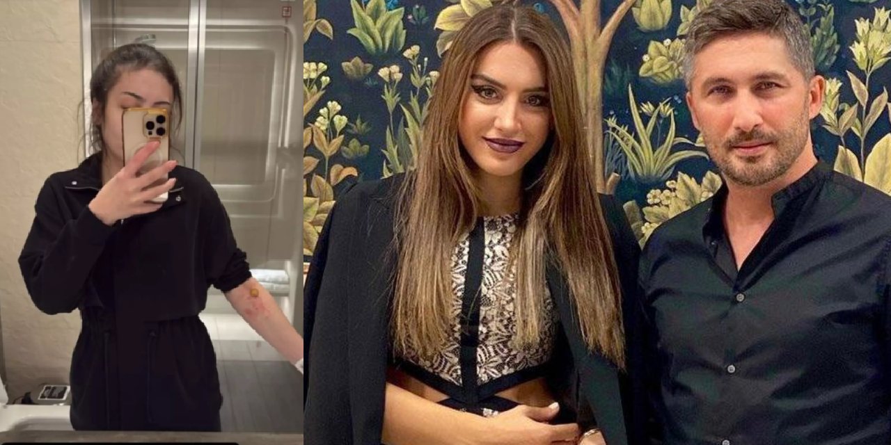 Lara Aslan’dan Sabri Sarıoğlu hakkında dikkat çeken çıkış: “Hastalığımın sorumlusu o”