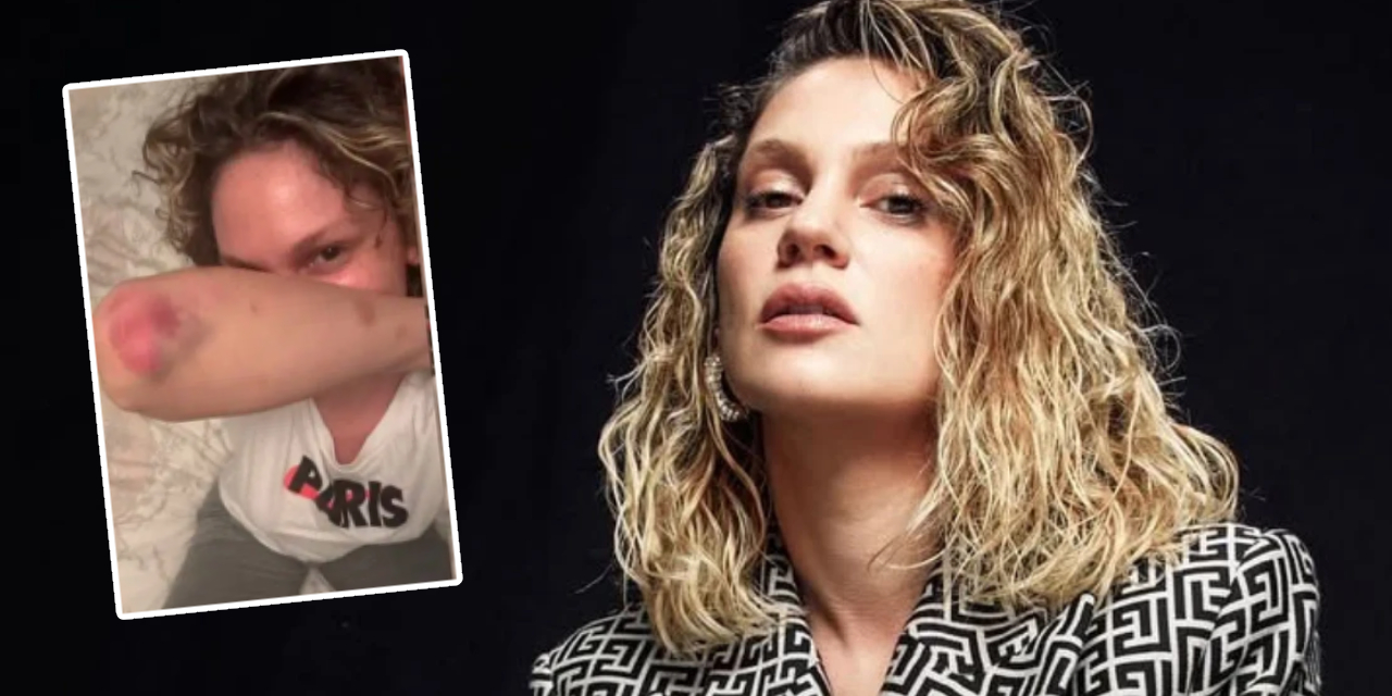 Farah Zeynep Abdullah'tan korkutan kare: Her yeri morluklar içinde kaldı